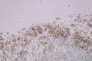 penicillium mould